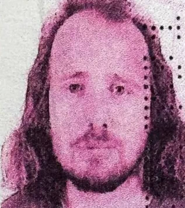 Imagen: Un británico de 36 años muere después de un trasplante de cabello y un tratamiento dental en Turquía