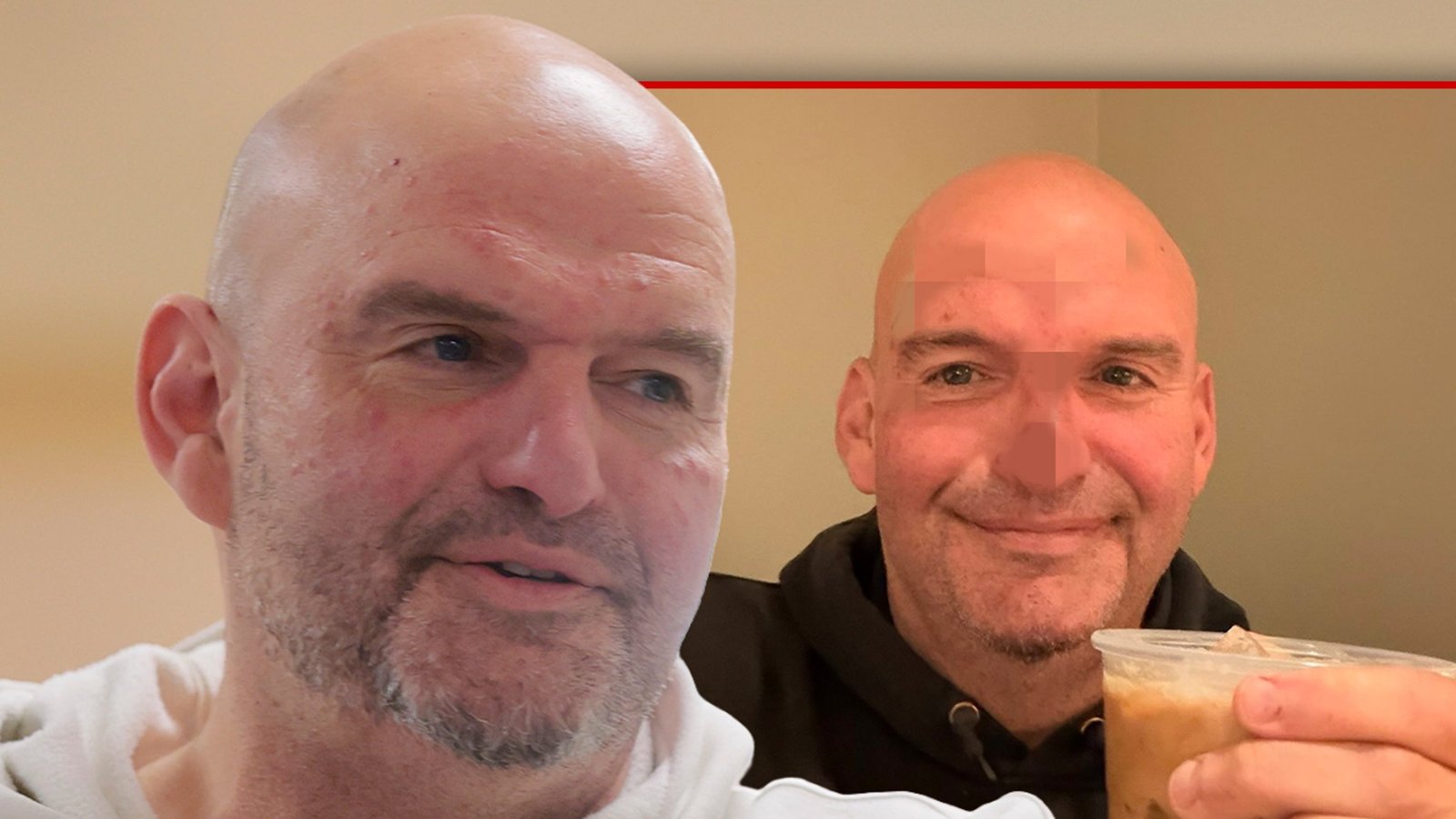 El senador John Fetterman dice que necesita 20 puntos y comparte una foto de su cara golpeada