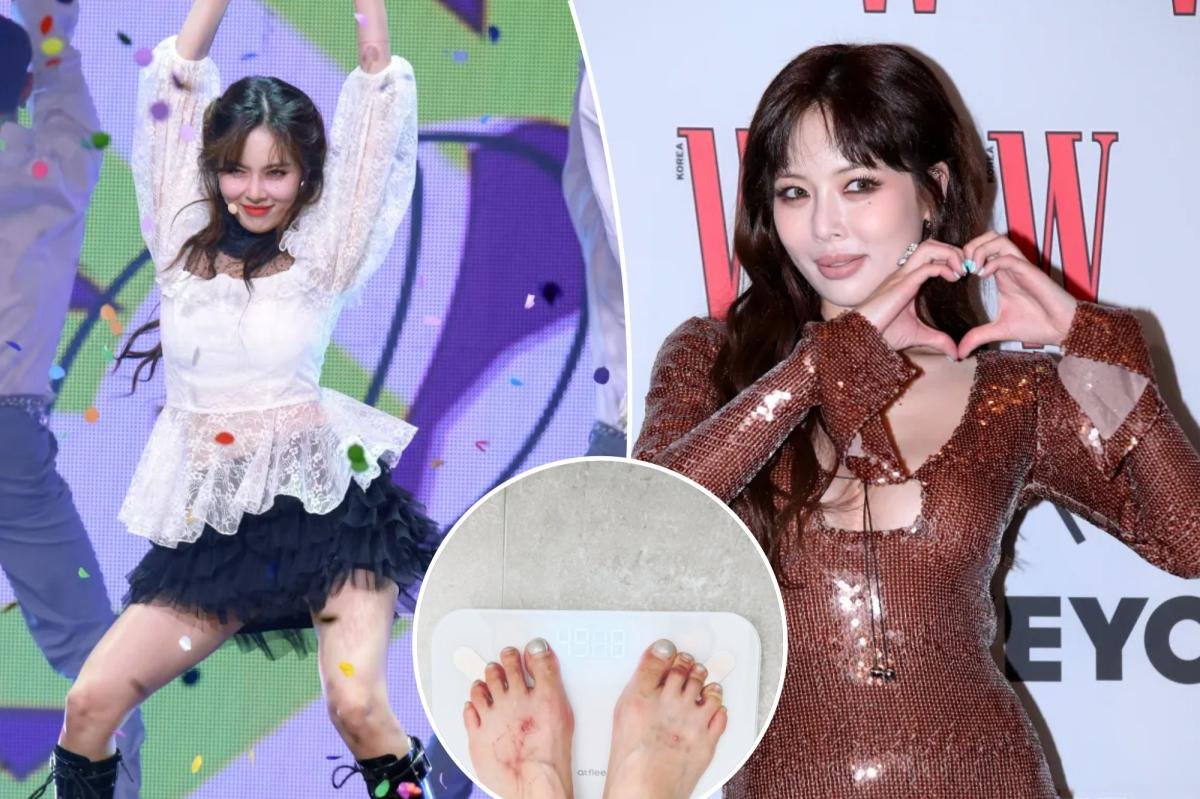 La estrella del K-pop HyunA colapsa a mitad de su actuación, generando preocupación por su reciente pérdida de peso