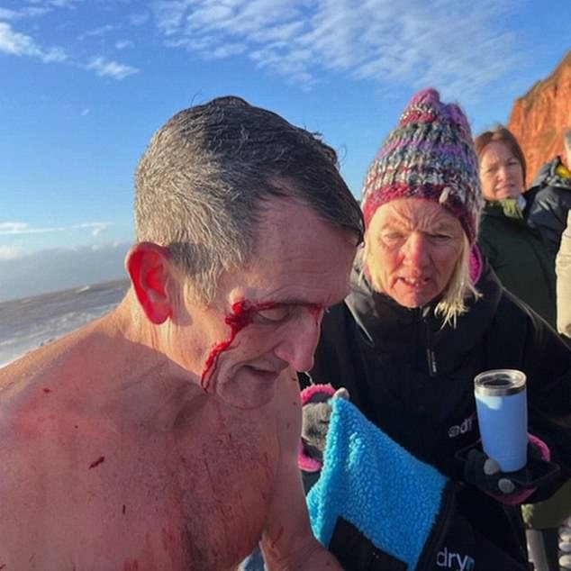 Un superviviente de la natación del día de Navidad que se cree que mató a dos personas dice que fue un «error entrar» después de ser rescatado de las «peores condiciones jamás vividas»