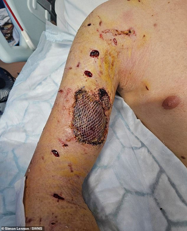 Un luchador aficionado de MMA se enfrentó a un matón de XL que lo arrojó «como un muñeco de trapo» durante un brutal ataque; entrenó para su «increíble» supervivencia.