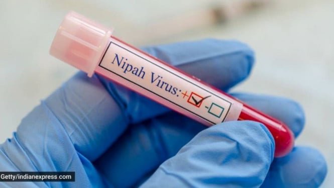 No existe vacuna para el virus Nipah, ¡cómo prevenir eficazmente la transmisión!