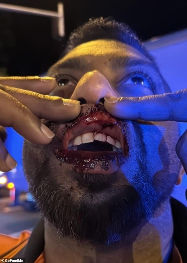 La brutal realidad de Melbourne en 2026: fui un cobarde en el trabajo y la policía no hizo nada