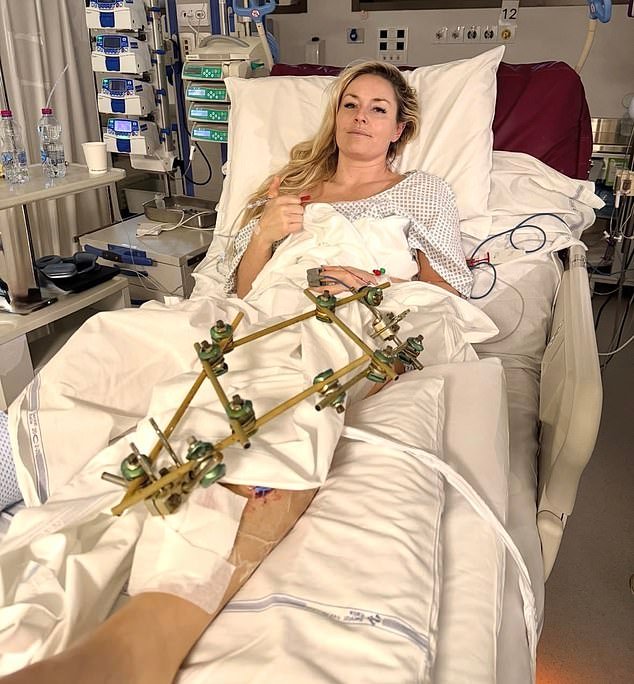Un cirujano revela lo peligrosamente cerca que estuvo Lindsey Vonn de perder su pierna después de un horrible accidente de esquí en los Juegos Olímpicos de Invierno