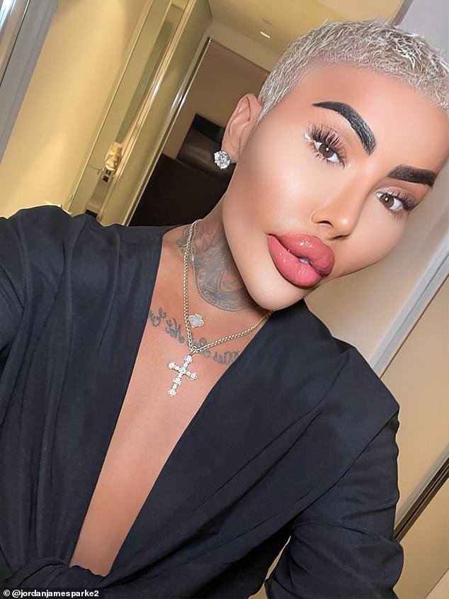 ‘Lip King’, obsesionado con Kim Kardashian, muere un año después de ser arrestado por la muerte de una madre de cinco hijos que murió después de BBL en su clínica