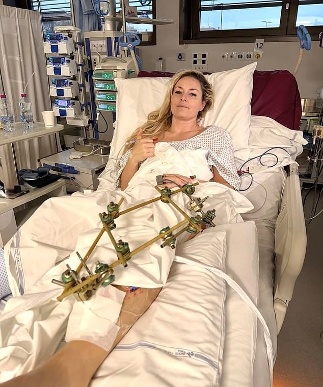 Lindsey Vonn insinúa que volverá a esquiar a pesar de su cuarta cirugía en la pierna rota después del terrible accidente de los Juegos Olímpicos de Invierno