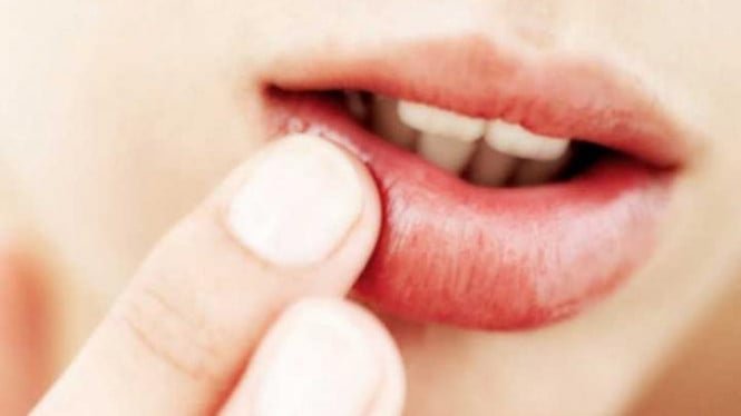 Los labios secos pueden hacerte sentir incómodo durante el ayuno, aquí tienes 9 formas de superarlos