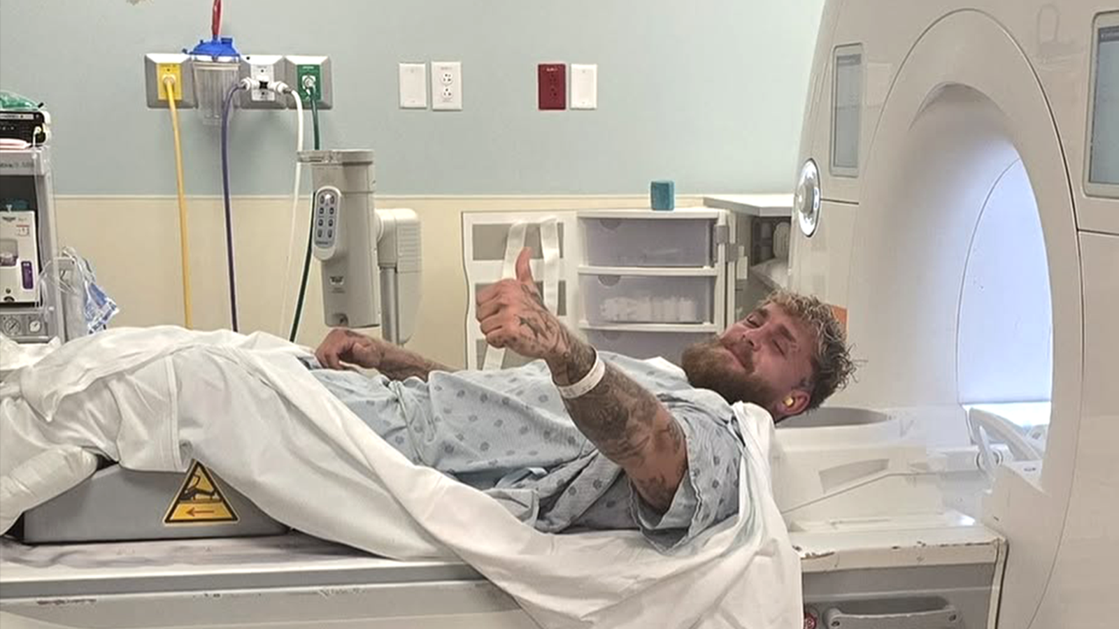 Jake Paul se sometió a una segunda cirugía por una fractura de mandíbula después de la pelea con Anthony Joshua