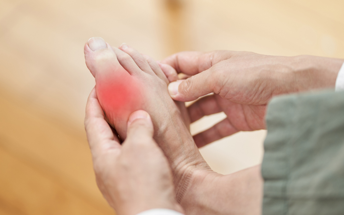 La ‘enfermedad de los reyes’ está aumentando en EE. UU. y millones de estadounidenses están en riesgo